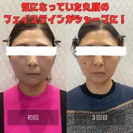 ★9/30まで【むくみ解消】首肩から整えて、根本にアプローチ10,000円▶︎1000円(小顔矯正部位別)