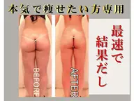【全身痩身🌻/平日限定】🍉夏までに🔥体型を変える💎気になる全身まるごと全身痩身90分🍉