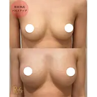 【本気の育乳‼️】全身マッサージで一回でふわふわ感動バスト✨️下垂/ボリューム/産後/左右差