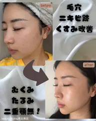 ✨先着5名様✨芸能人の方も愛用。パスリル美顔器体験➰たった5分で-3kg小顔になります。1回で大感動オススメメニュー❕