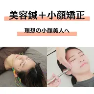 《🪡初回限定🪡》美容鍼＋小顔矯正＋ドライヘッドスパ（60分）　💄メイクオフ不要💄