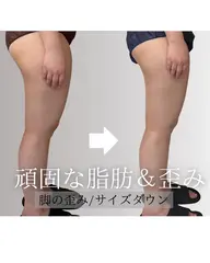 【脚痩せ】整体師が行う美脚エステ◎むくみ/脚のサイズダウン/セルライト90分