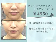 フェイシャルワックス＋光フェイシャル ￥4,950