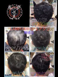 ACTIVART発毛促進炭酸スパ&カット