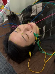美容鍼🍀1回の施術だけでなく2回で1セット