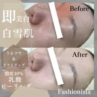 【今だけお試し】7月限定シミそばかす毛穴の開きを引き締めくすみを美白にするスノーピーリング