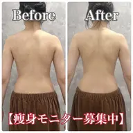 【導入モニター】二の腕&背中集中◆脂肪AI測定×超音波60分