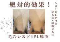 つるぴか全身脱毛🩵✨オーダーメイドで毛質チェックさせて頂きます!!