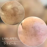 【新規】乾燥、小ジワ、くすみが気になる年齢肌に、肌を育てるピーリング🫧‪