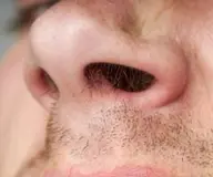 お出かけ前に‼️ここ一番って時に‼️✨ノーズWax👃(他メニューと組み合わせてご予約ください☆)