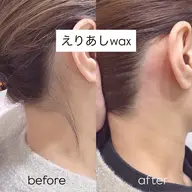 ワックス脱毛セレクトコース【うなじ or 両脇】