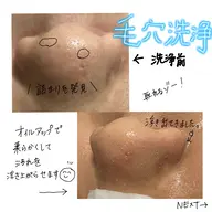 毛穴洗浄