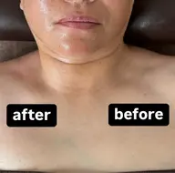 🧖♀️小顔ケア🧖♀️EMSで小顔に
