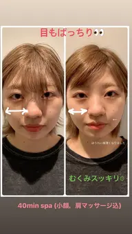 【頭も顔もスッキリ⭐】リラクゼーション炭酸 20minヘッドスパ+コラーゲンパック+ケアプロ超音波アイロン