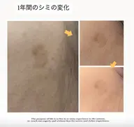 シミにお悩みの方✨徹底美白コース✨¥9,900→¥6,600 イオン導入➕パック