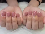 深爪矯正コース