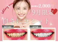【9月限定🌟エリア最安値!!】強力セルフホワイトニング30分初回体験 ¥7980→¥2000