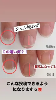 『1回 体験』ジェルを使わない❣️3ヶ月で自爪育成😊🤍