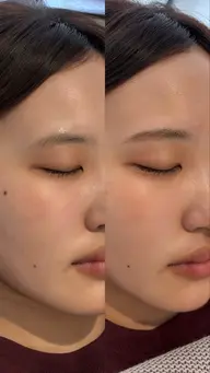 HBL毛流れ改善（美眉スタイリング・ワックス）　　　　　　　💫撮影モデル募集9月末まで