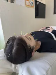 🍀美容鍼+体質改善 10名様限定🌟口コミ割