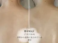 🩵minimoセール🩵【 背中全体ワックス脱毛(うなじ･背中･腰)🎀 】
