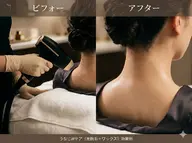 🌱【今月人気No.1】💎うなじW脱毛(光+ワックス)|初めての方にも安心して通える都度払い可メニュー◎