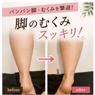 脚のむくみ クイック体験