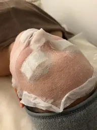 【肌育美容法剥けないスキングローケア】