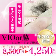 《VIOシュガーリング脱毛モニター募集》通常価格より『50%OFF』！！