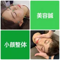 【 美容鍼 + 小顔整体 】(目元スッキリ、お顔のむくみスッキリ)カウンセリング付 70分 ¥9,000→¥4,800