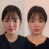 小顔整顔矯正
