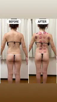 モニター撮影限定‼️【3回セット】よもぎ蒸し35分×全身スリムボディ(よもぎ蒸し+全身痩身マッサージ)