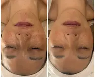 上半身エステ