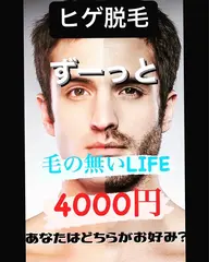 ヒゲ脱毛