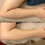 【夏女シリーズ】腕全体