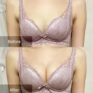 写真モニター価格【下垂/離れ乳改善】上半身＆バストマッサージ＋美乳マシーン初回体験
