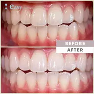 【🩵easy whitening 会員様専用メニュー🩵】