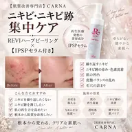 【ニキビ・ニキビ跡ケア】お試しREVIハーブピーリング☆陶肌パウダー＋IPSP幹細胞セラム入り🎁