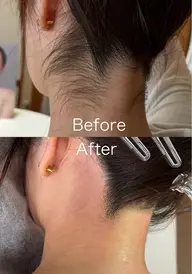 うなじWAX🧡🪄