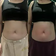 オンダリフト 腹部🔥お腹周り集中ケア