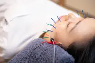 🥇人気No.1🥇気になる毛穴の開きにも！最先端電気美容鍼⚡️