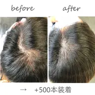 お試しカウンセリング+増毛エクステ500本
