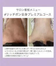 ❣️ボディリンパエステ❣️辛いコリに効果抜群のリンパケア❣️不要物排出ジェルを使用し要らないものをグングン出してスッキリ