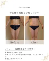 【代謝促進EMS+実用新案技術サイズダウン1パーツ】業界唯一✨️セル脂肪✨️燃焼✨️モニター/関西唯一⭕️