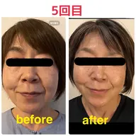 顔まわりのスペシャルケア/ヘッド＋フェイシャル＋デコルテ60分