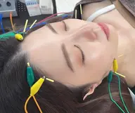 【リフトアップ効果を更に高める！】リフトアップ美容鍼❣️ヘッドマッサージセット❣️