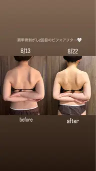 ブライダルオススメ✨ドレスから見える✨背中、二の腕、デコルテ、腰回り、肩甲骨剥がし、巻き肩改善♡