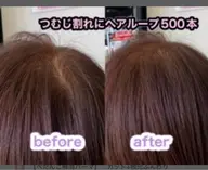 つむじの割れを解消エクステ。ヘアループ。ボリュームアップエクステ500本