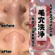 🫧鼻だけ毛穴洗浄🫧1回でも効果👍⏰30分