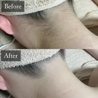 🚺【レディース背面脱毛】(補足説明を確認してください)1回のみの使用可能です⭐️口コミ→ドライヘッド